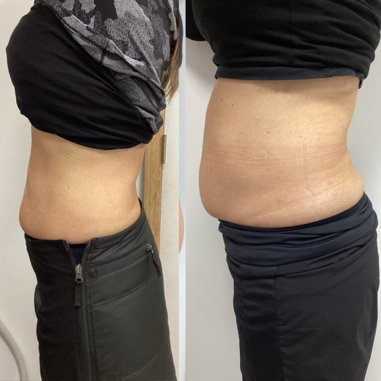 Before and after weight loss: Side-by-side images show a person's midsection in black attire, with a noticeable change to a flatter stomach.