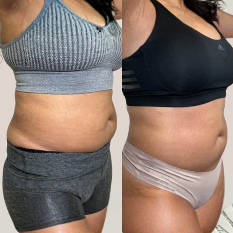 Woman’s midsection before and after, wearing different sports bras and bottoms, showing body shape changes side by side.
